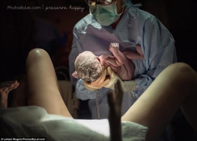 Το θαύμα της γέννας – Συγκλονιστικές φωτογραφίες πριν και μετά τον τοκετό