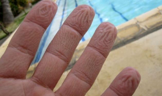 Αναρωτήθηκες ποτέ γιατί “μουλιάζουν” τα δάχτυλα μας στο νερό;