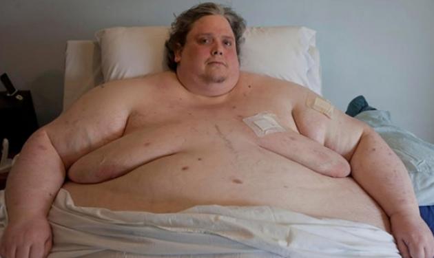Πέθανε ο πιο παχύσαρκος άνθρωπος στον κόσμο!