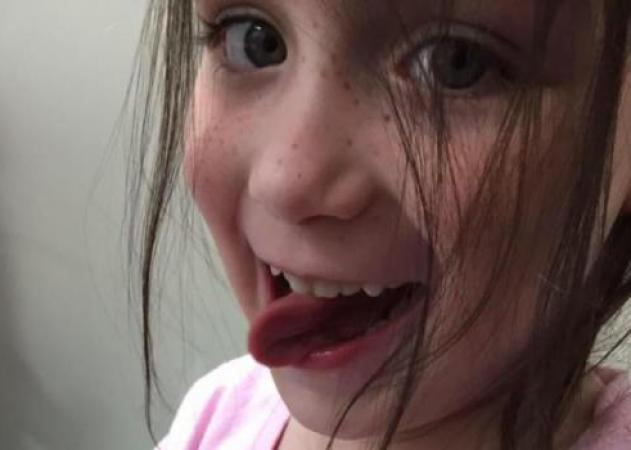 Ραγίζει καρδιές η φωτογραφία με την τελευταία βλεφαρίδα κοριτσιού, μετά από σειρά χημειοθεραπειών