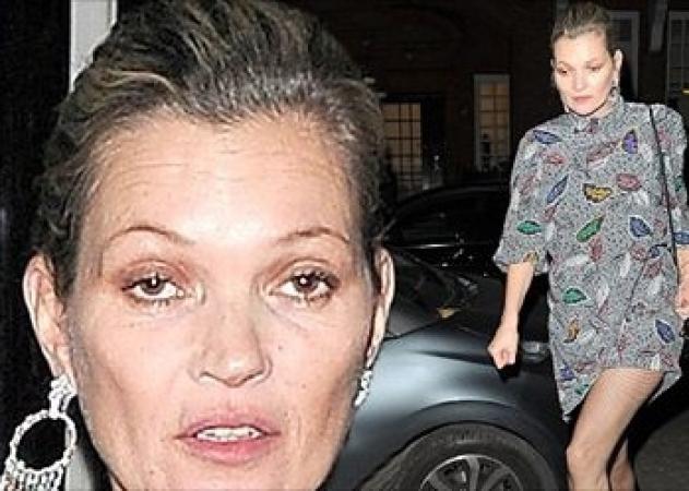 Η Kate Moss στα… χειρότερά της!