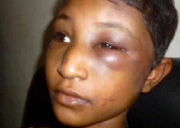 Συγκλονιστική μαρτυρία 11χρονης για διεθνή αθλητή: ”Με χτυπούσαν με ραβδιά”