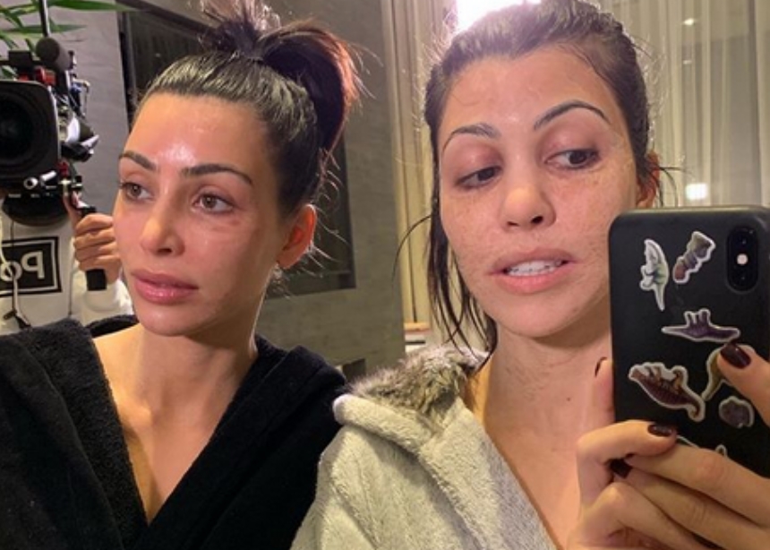 Τι έπαθαν στο πρόσωπο η Kim και η Kourtney Kardashian;