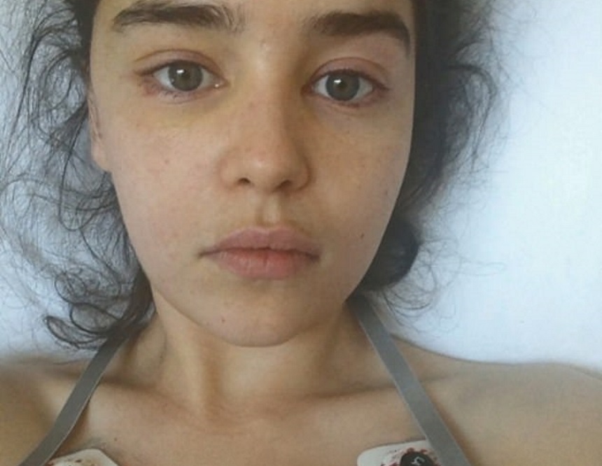 Emilia Clarke: Είχε υποστεί δύο εγκεφαλικές αιμορραγίες -Συγκλονίζουν οι φωτογραφίες από το νοσοκομείο!