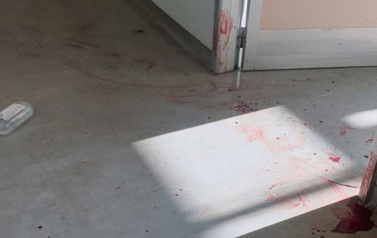 Σοκ στον Αττικόν! 59χρονος μαχαίρωσε νοσηλεύτρια και αυτοκτόνησε