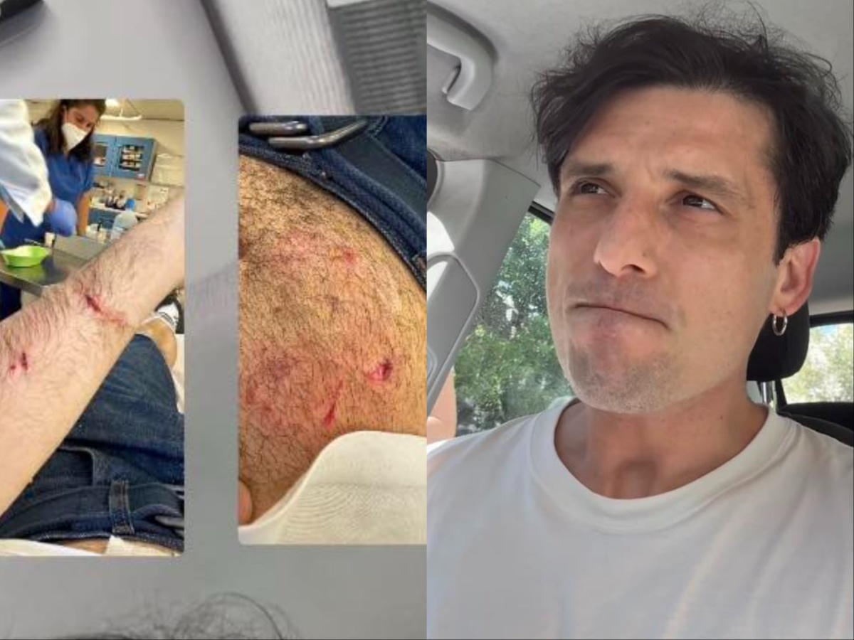 Σπύρος Χατζηαγγελάκης: Δέχτηκε επίθεση από σκύλο σε πάρκο και μεταφέρθηκε στο νοσοκομείο – «Άρχισα να φωνάζω και κρύφτηκα»
